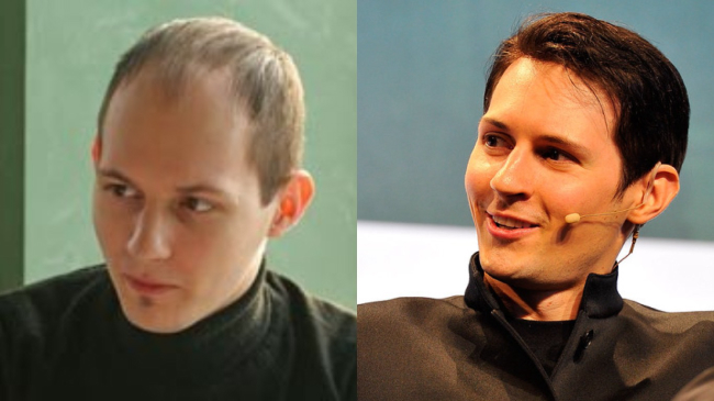 Пересадка волос кардинально изменила внешность Павла Дурова